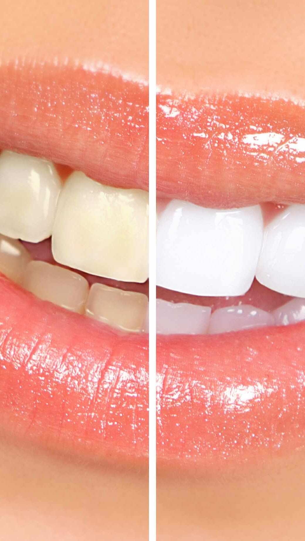 7 Herbs that help in teeth whitening
