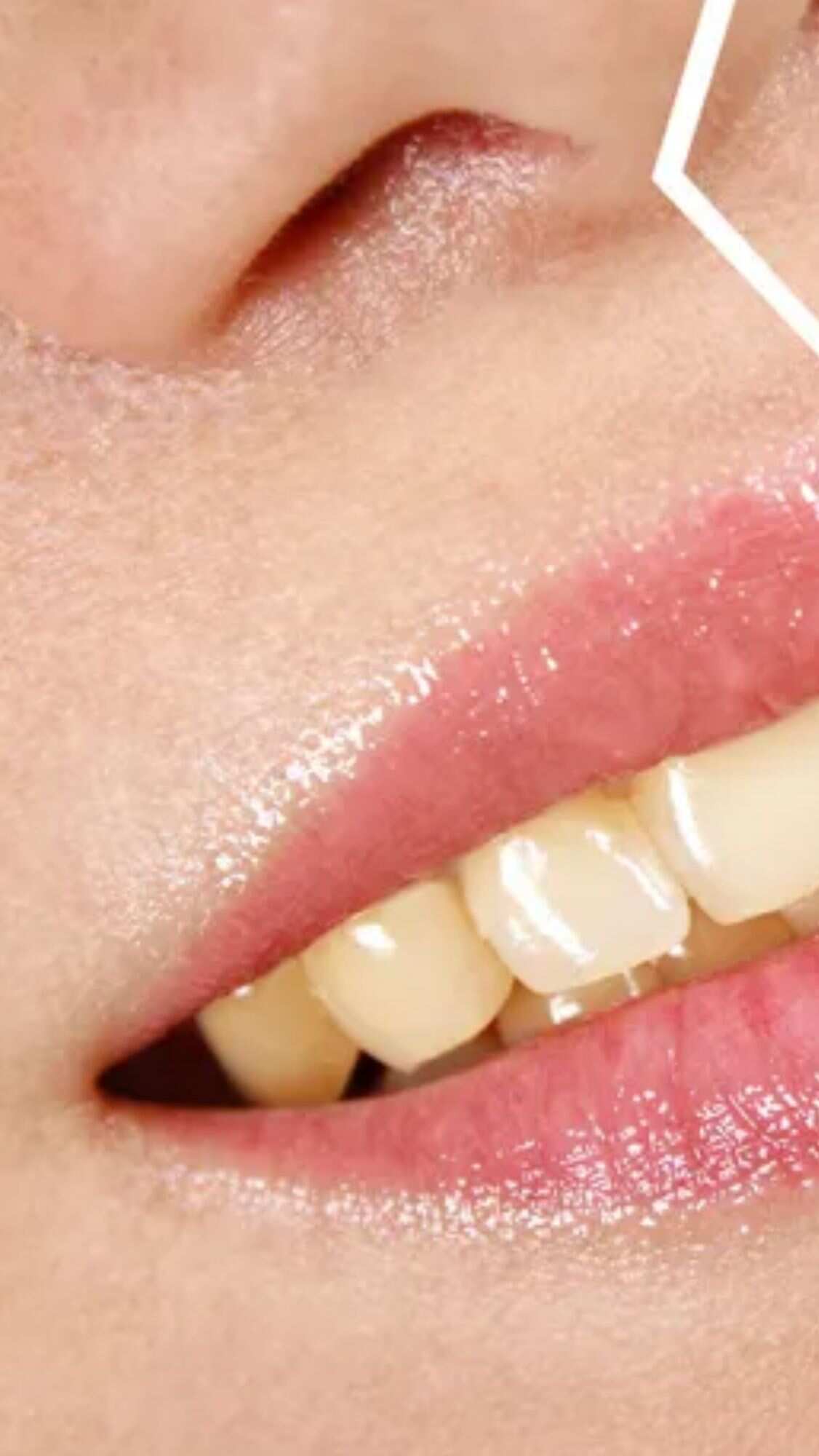Have yellow teeth? Follow these remedies to whiten them