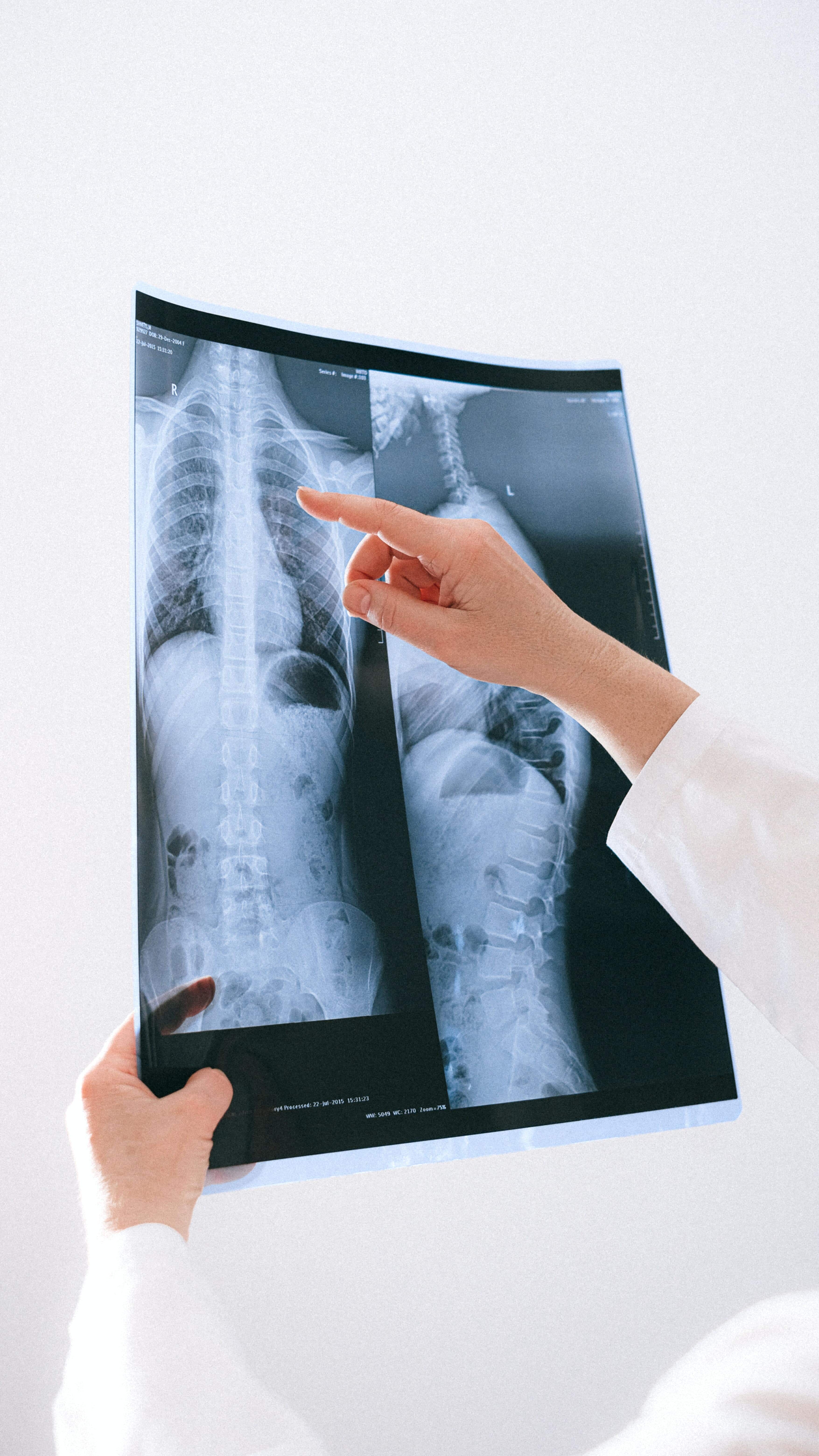 Chest infection 10 superfoods to fight pneumonia